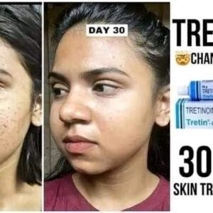 Tretinoin Tretin 0.025% Cream 30g